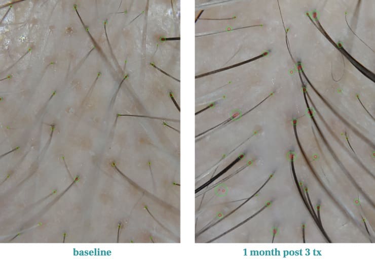 Sample Hair Restoration Program image